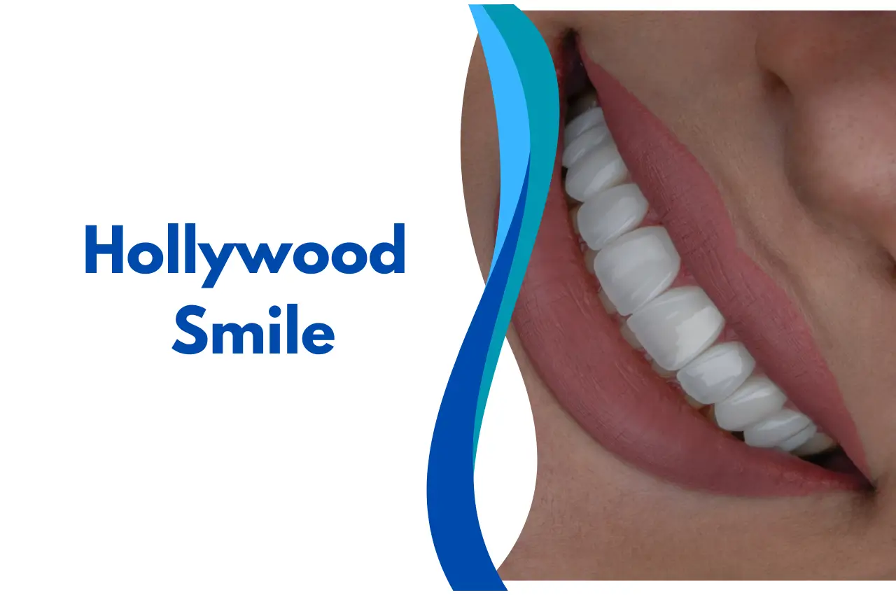 Hollywood Smile