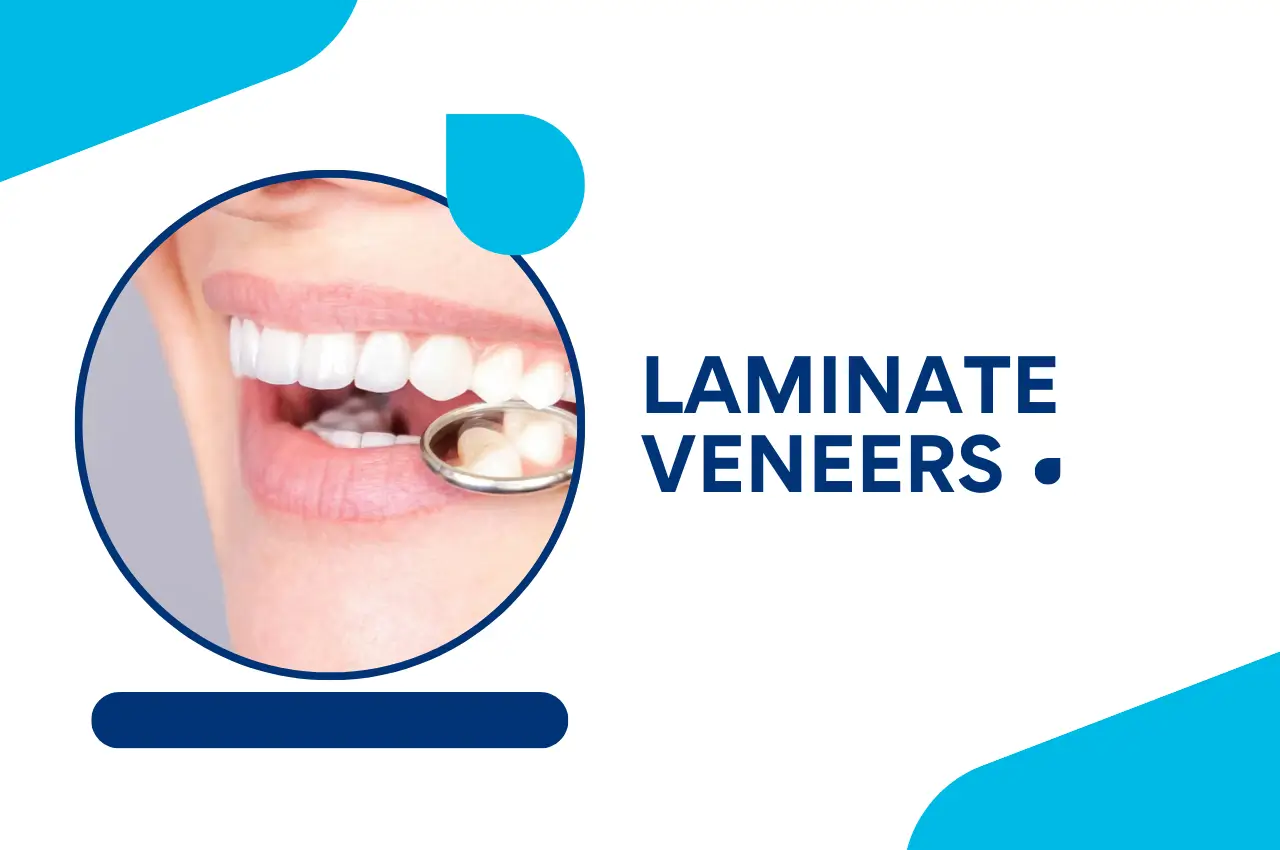 Laminate Veneers