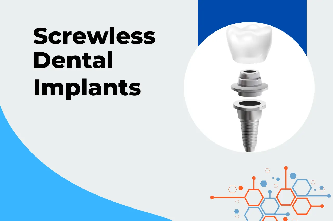 Screwless Dental Implants