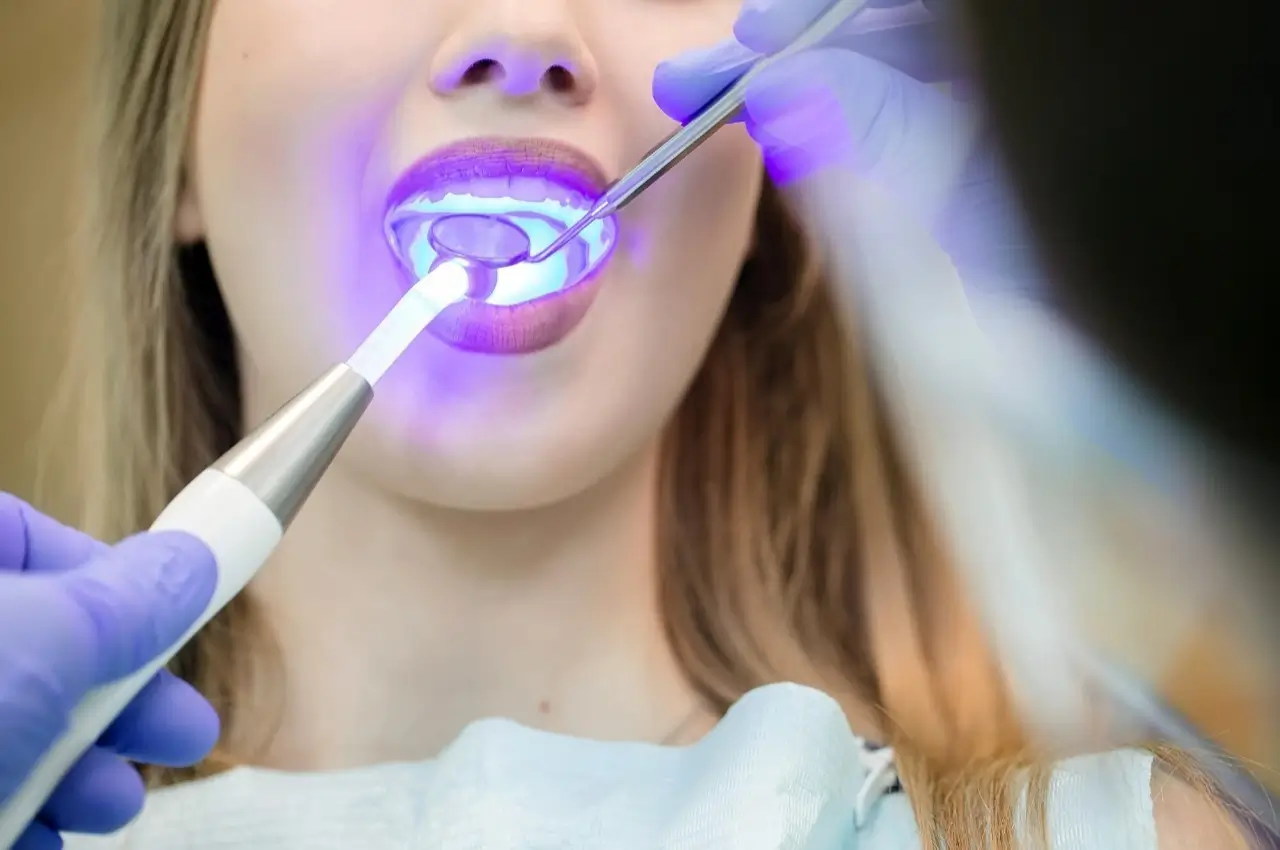 Teeth Whitening