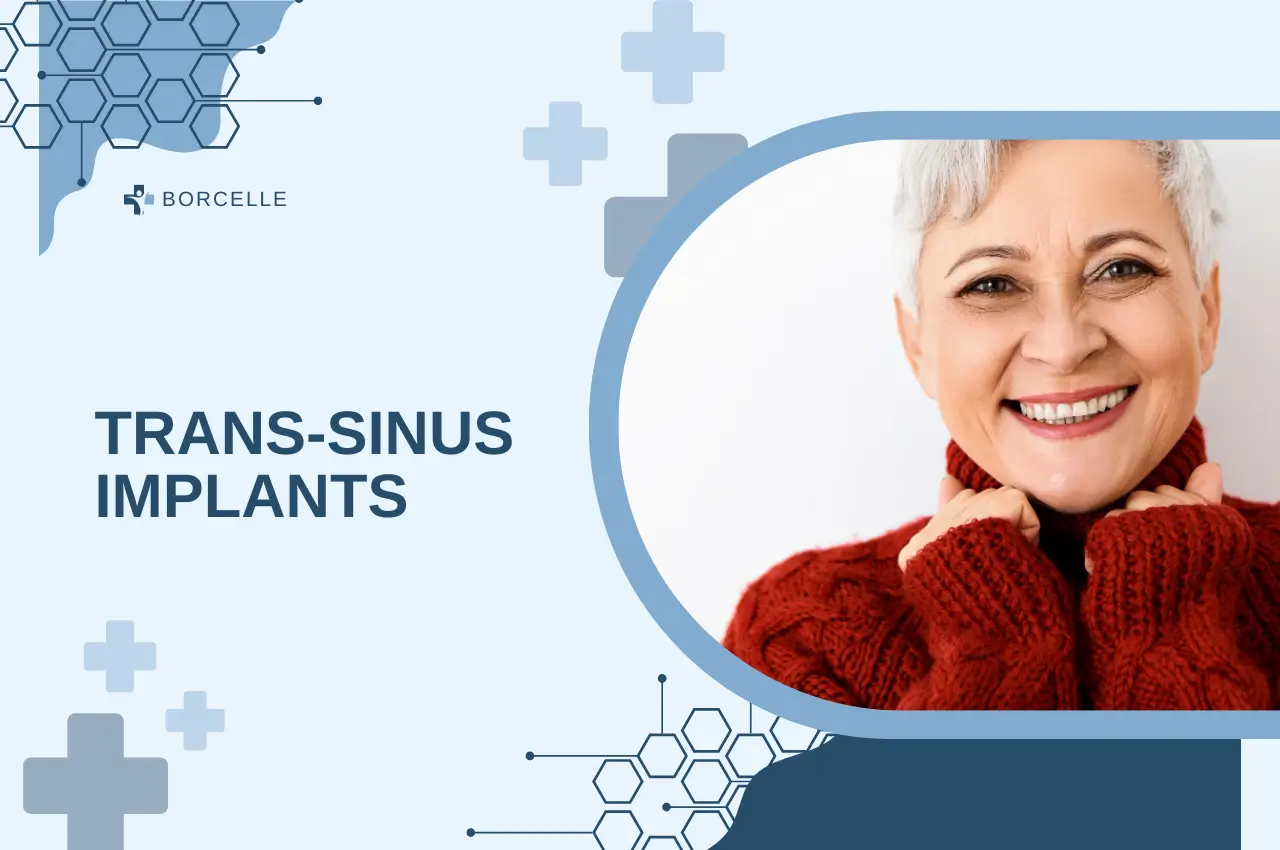 Транс Синусови зъбни импланти